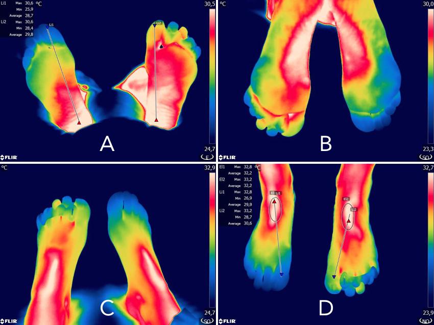 ct ir 3